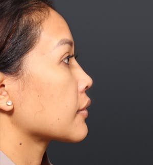 1609199199 4c464ade 8cdb 4e9d afb6 e4644c04ae82