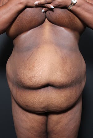 1609200532 8953857c f4ee 4f45 a325 2774e98640f3