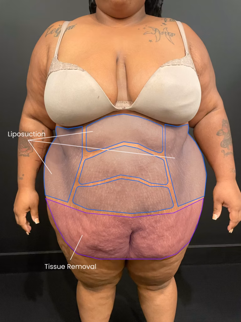 1728943664 patient a before