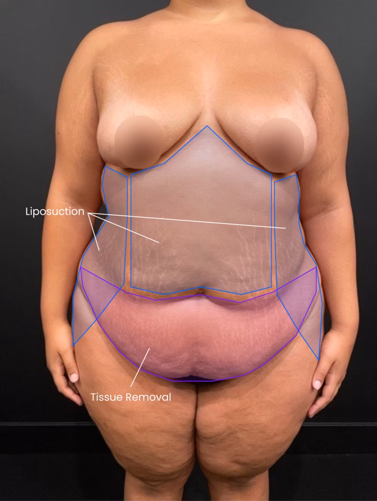 1728943664 patient b before