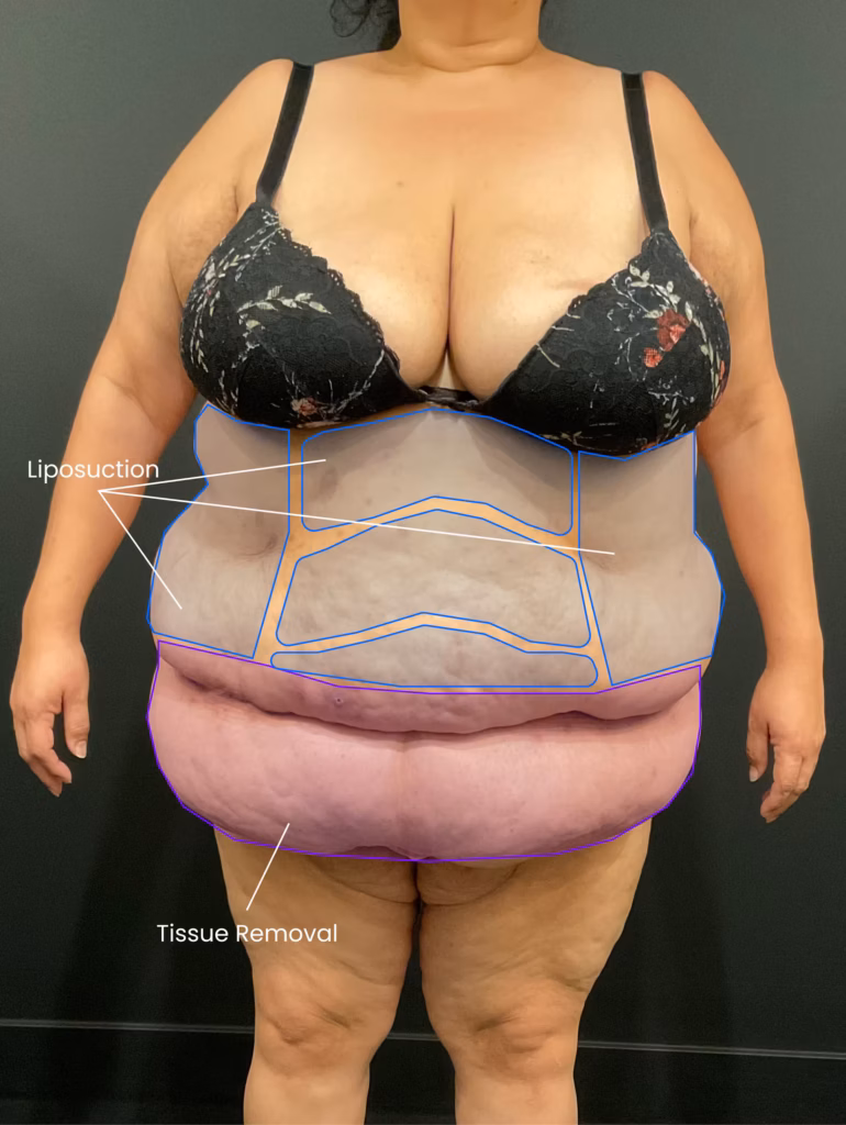 1734639247 4 before 1