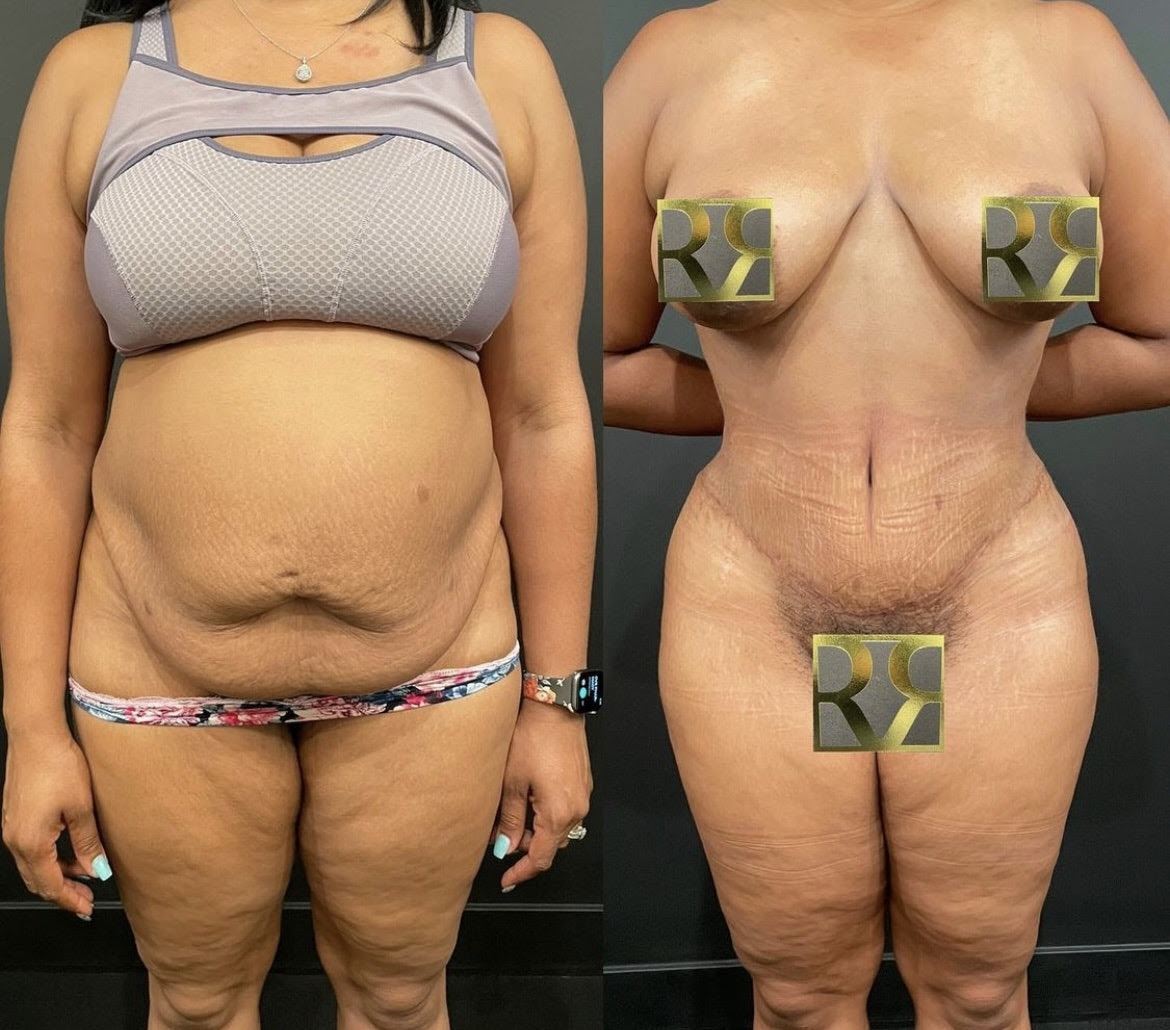 1762876881 1657292389 repta scarring 1