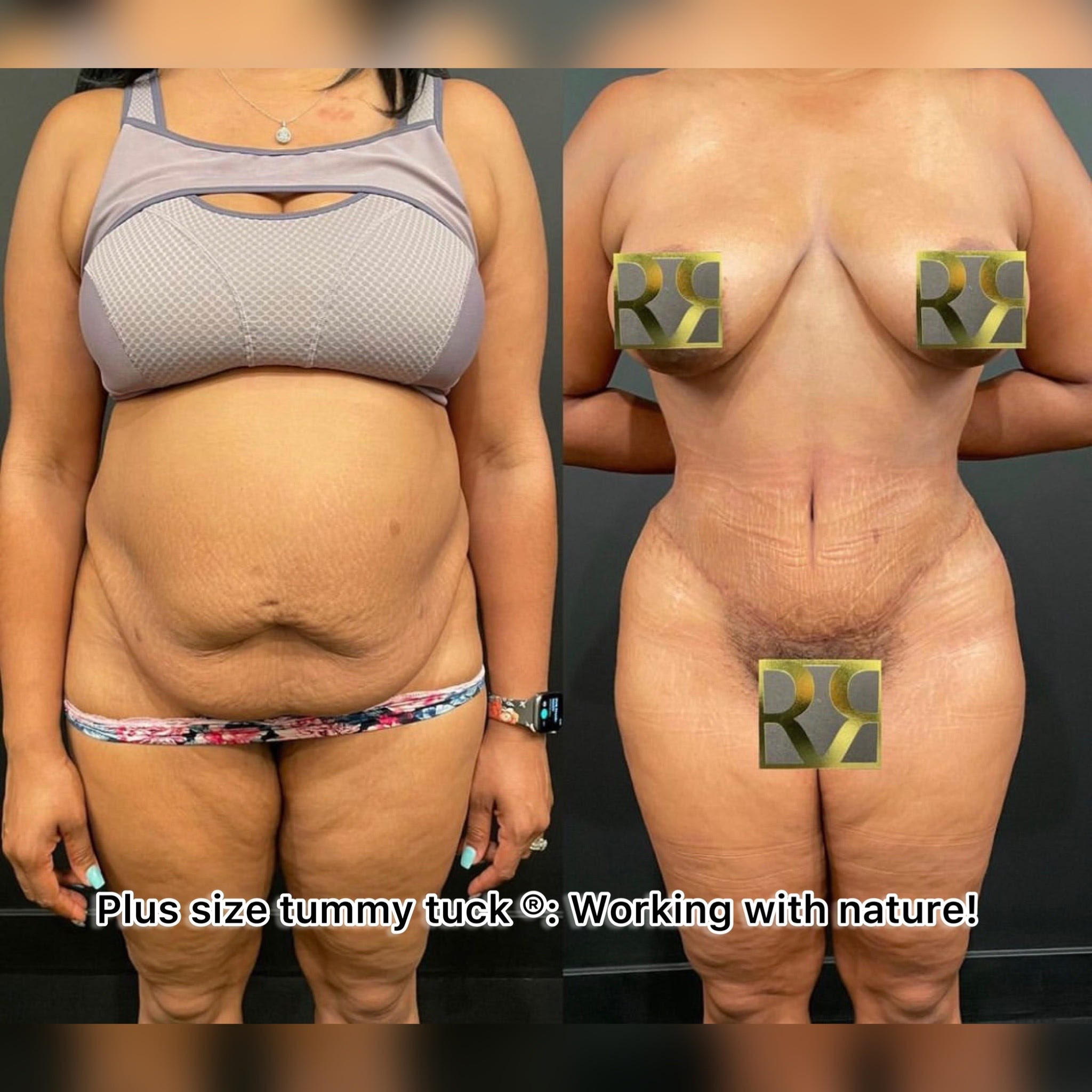 1762876902 1659972397 unnamed 1 1