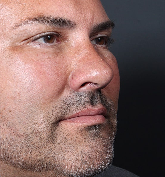 1762877035 1609198529 c81f8e8b debb 4ea3 ad2a 8b89adba84b8 1 1