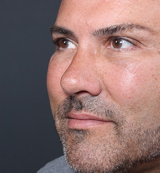 1762877052 1609198474 ffd2789a 7cda 4b6a b62b e7cbc47704ab 1 1