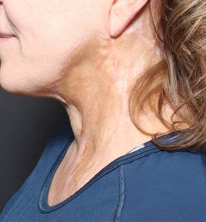 1762882507 1609199294 ad5394ea 4db9 4c46 b003 440ab67f2868 1