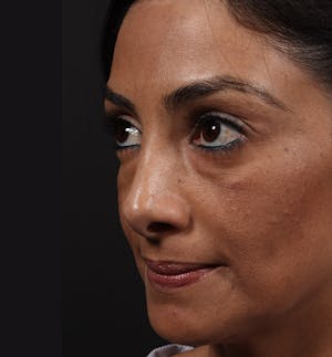 1762882526 1609199101 ae49c9a1 ed62 4627 9fa8 8da24637729e 1 1