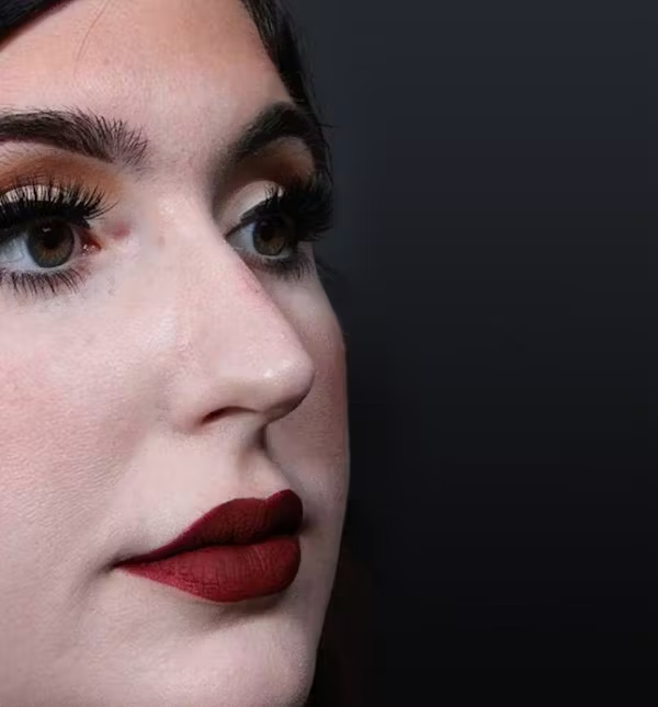 Before Image: Rhinoplasty - right-front-oblique