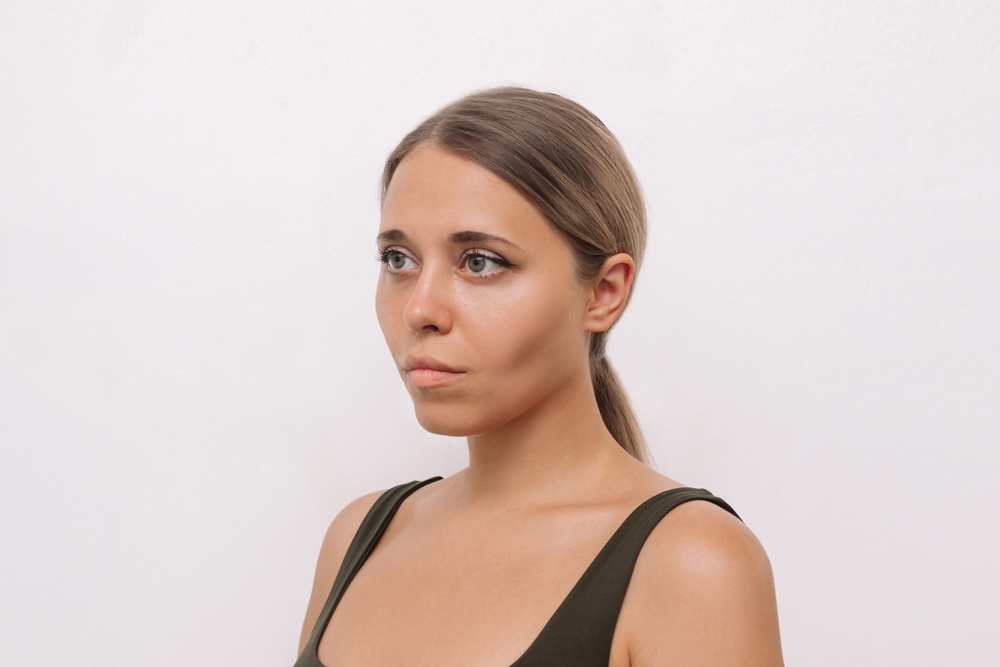 Young woman with sunken cheeks, in need of facial fat grafting to restore facial volume and refresh her appearance. Young woman with sunken cheeks, in need of facial fat grafting to restore facial volume and refresh her appearance.