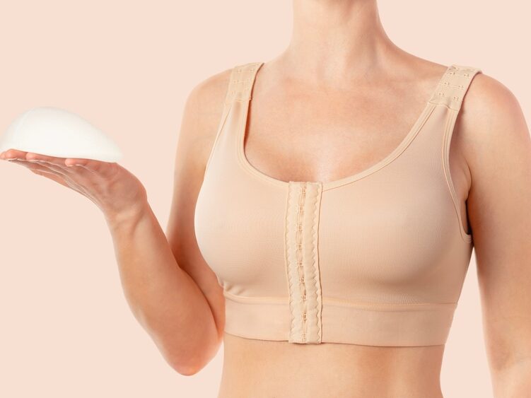 Woman in a compression bra holding a breast implant after breast implant revision Woman in a compression bra holding a breast implant after breast implant revision