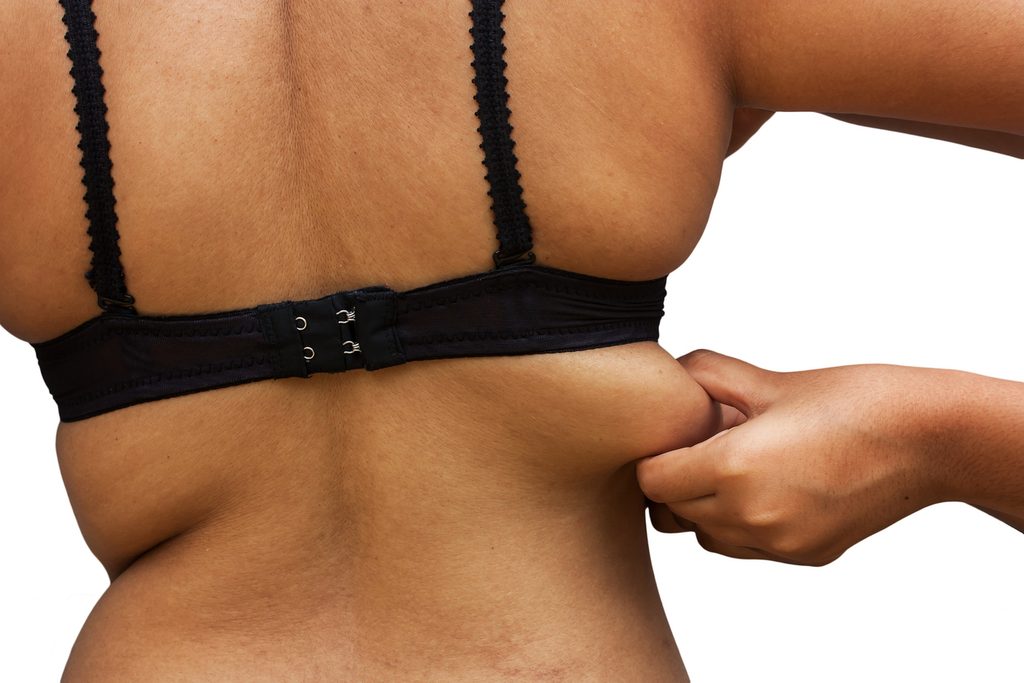 Cropped shot of a woman pinching back fat before upper body contouring